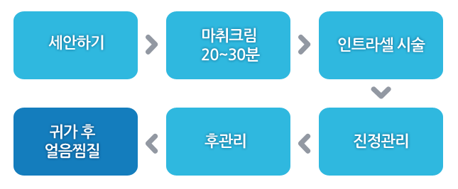 인트라셀 시술 순서