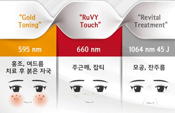 골드토닝