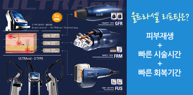 울트라셀 리프팅