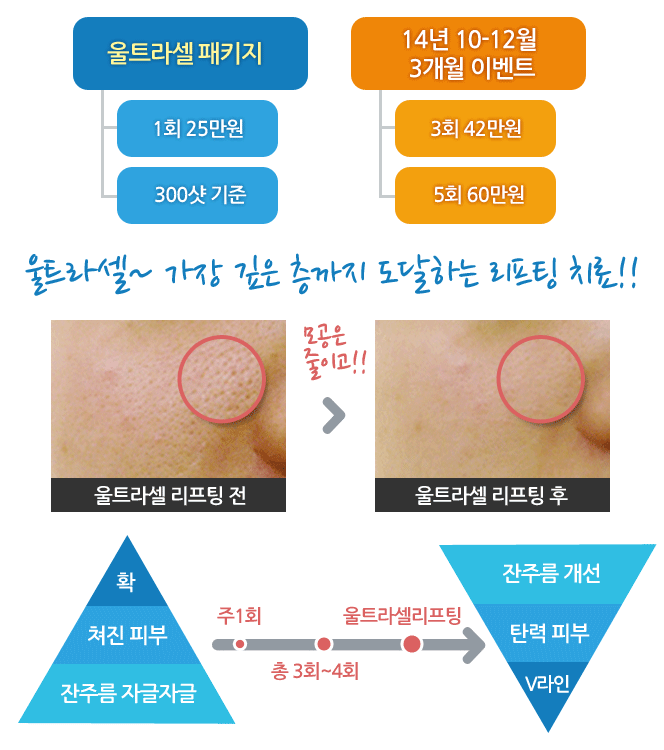 울트라셀패키지