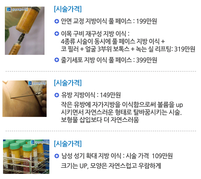 시술가격